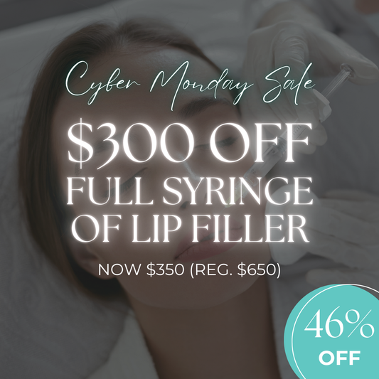 Cyber Monday Exclusive: $300 Off Lip Filler!